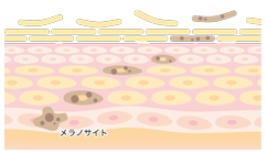 ターンオーバーの様子